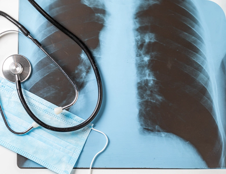 general-xrays